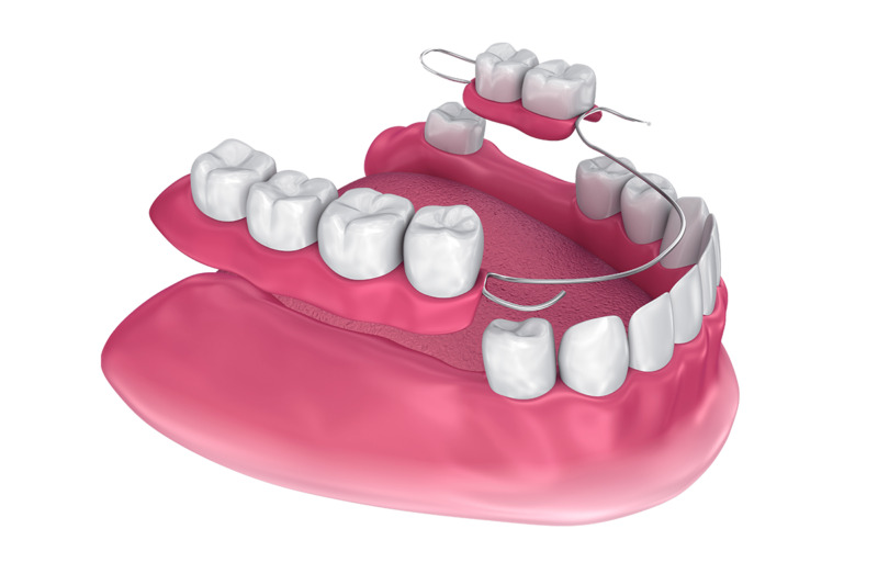 dental-denture