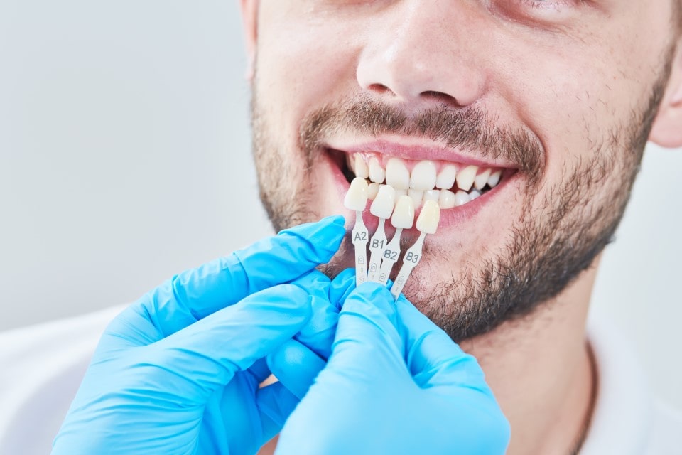 Dental Bonding & Veneers