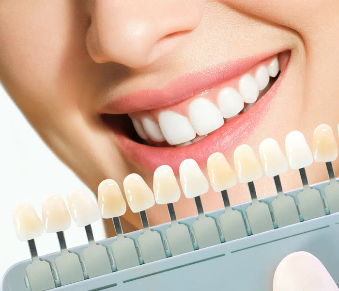 Cosmetic-Dentistry