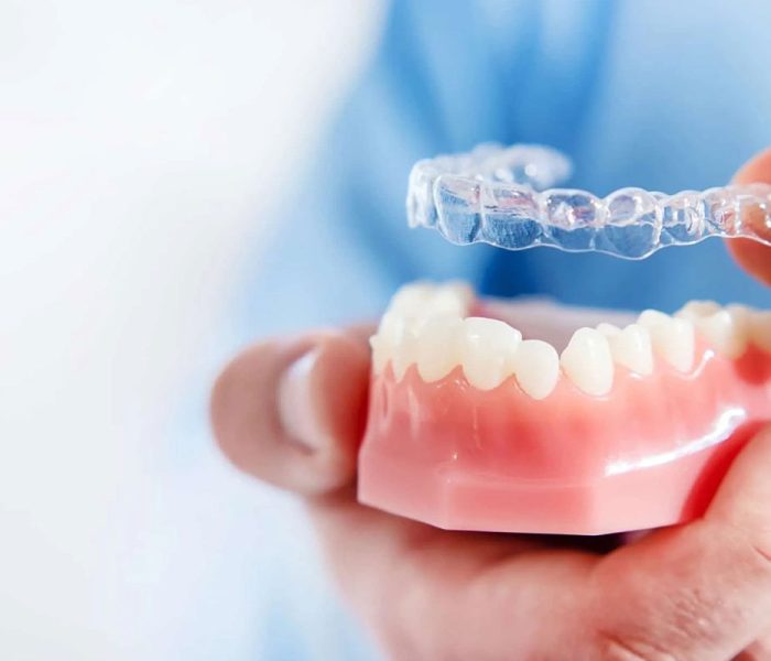 invisalign-treatment