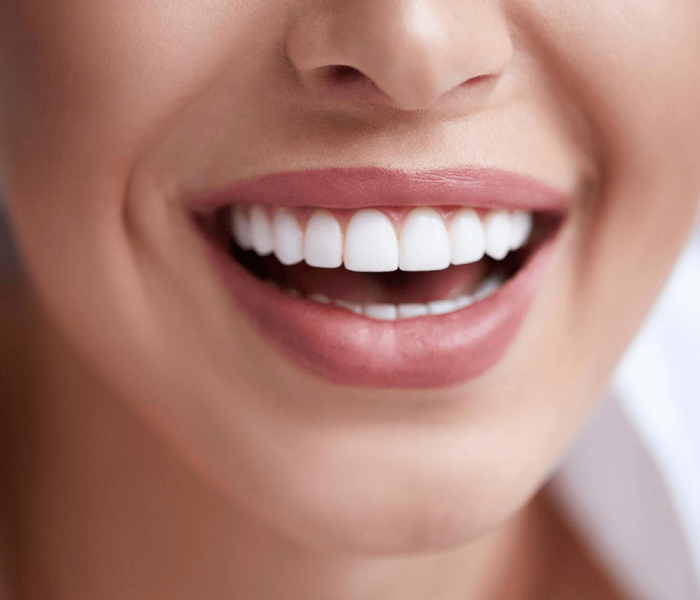 olive_teeth_whitening