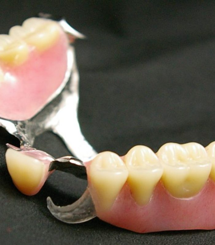 partial-dentures